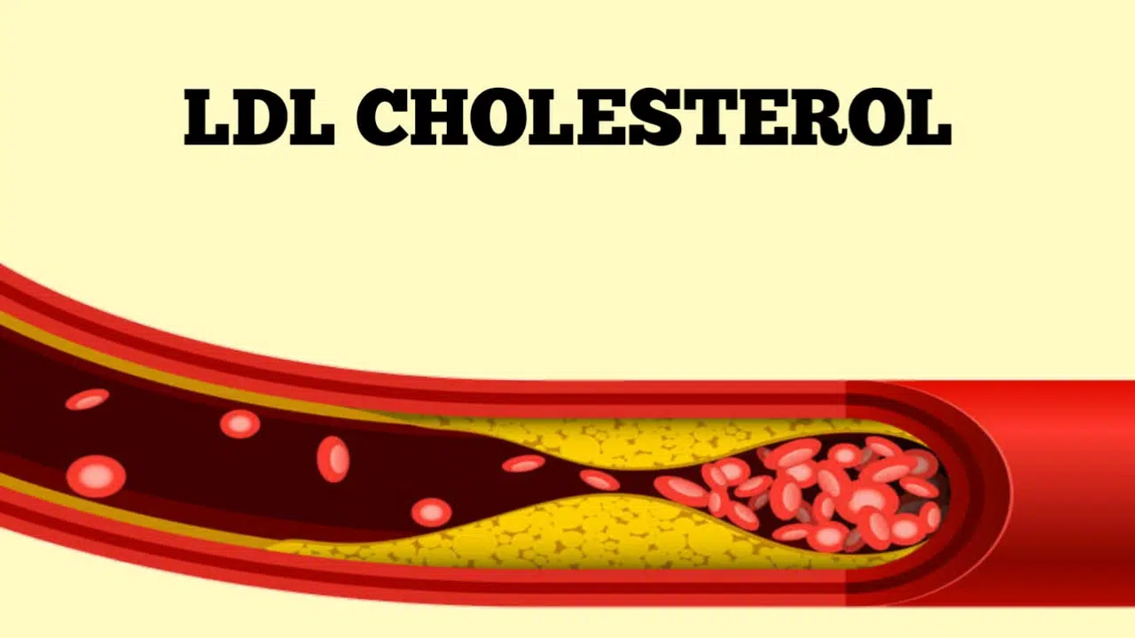 High cholesterol